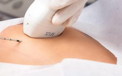 Cáncer de mama en Colombia: 15.500 casos al año evidencian la urgencia de diagnósticos más precisos